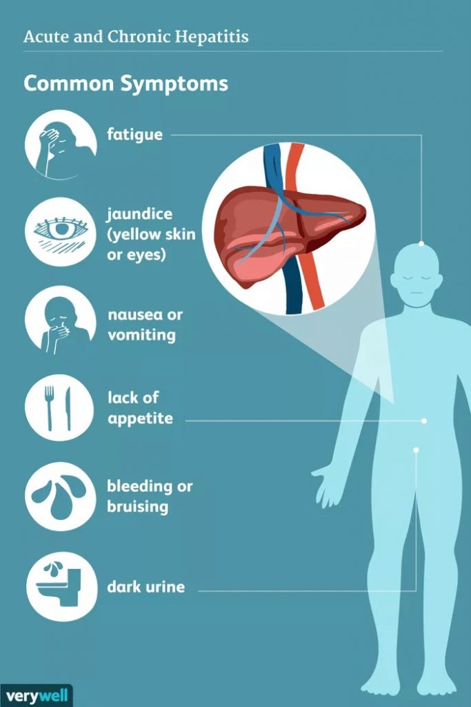 » Hepatitis C